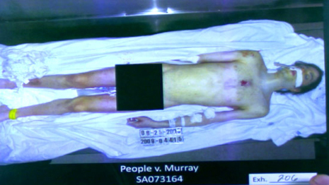 Фото, сделанное во время вскрытия тела Майкла Джексона, демонстрировалось н ...