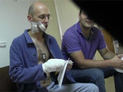 Журналист Сергей Асланян получил больше десяти ударов ножом